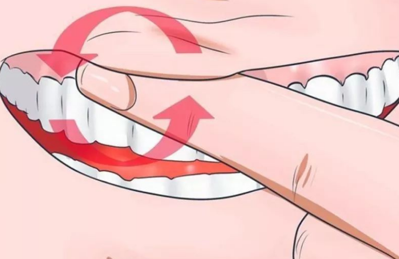 深圳牙周治療-女性激素水準變化會引起牙齒鬆動嗎？