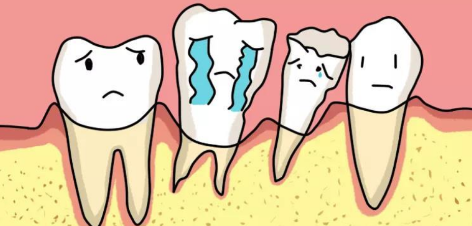 深圳牙周治療-骨質疏鬆會導致牙齒鬆動嗎？