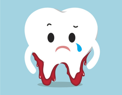 得了牙周炎怎麽辦？應該如何治療？