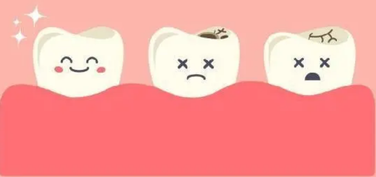 深圳兒童牙科-小朋友怎樣預防蛀牙呢？
