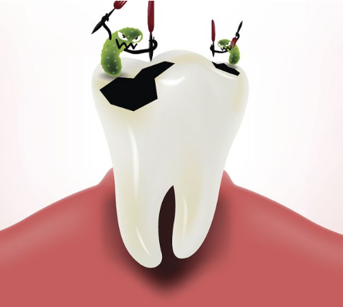 深圳牙周治療——牙齦萎縮怎麼防治呢？