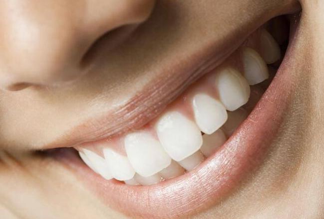 牙齒美白的3大誤區