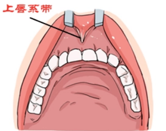 深圳牙齒美白