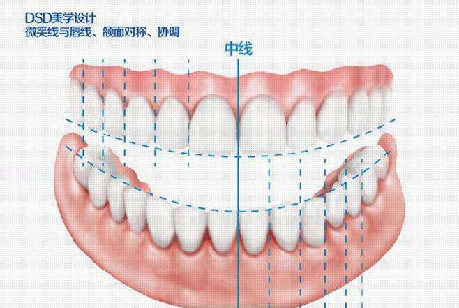 DSD微笑設計