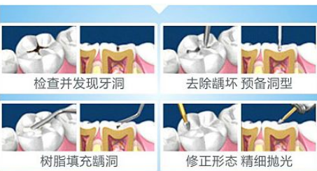 深圳種牙邊度好