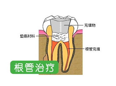 深圳杜牙根