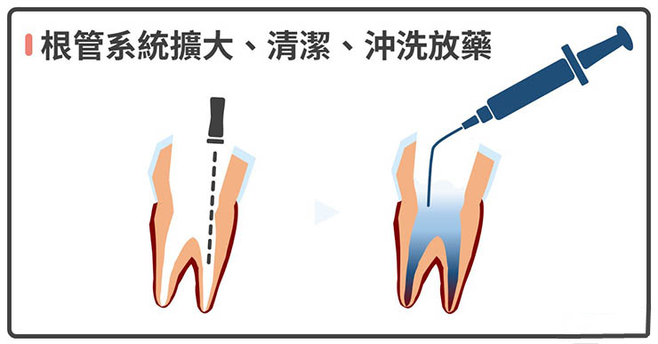 深圳杜牙根