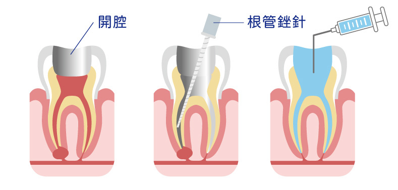 深圳杜牙根