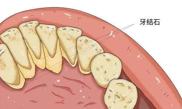 深圳牙周專科