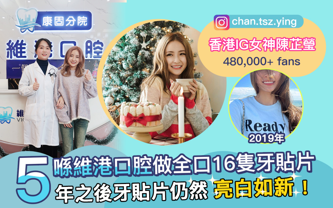 深圳牙貼片邊間好