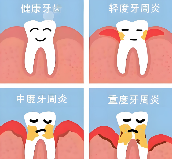 維港口腔牙周治療