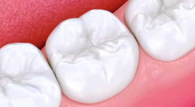 深圳補牙
