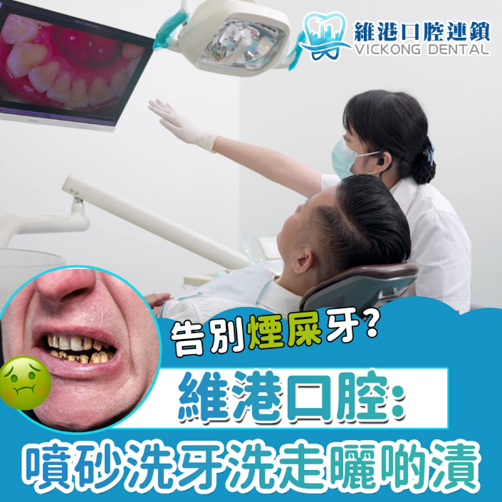 深圳洗牙價錢