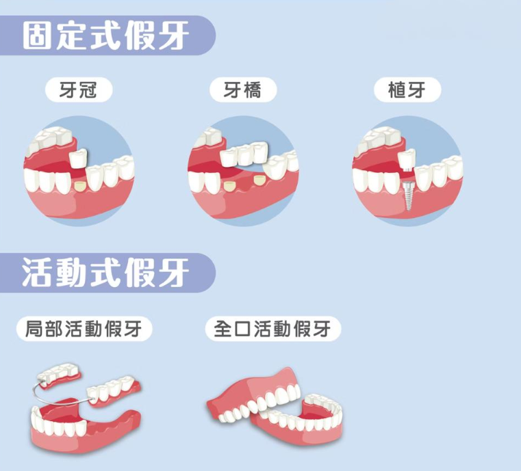 深圳假牙