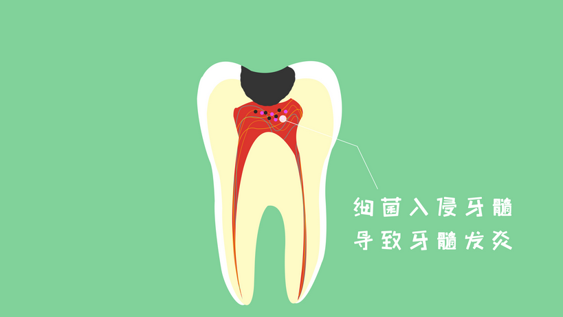 深圳杜牙根推薦
