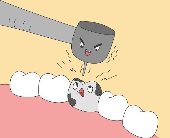 深圳杜牙根推薦