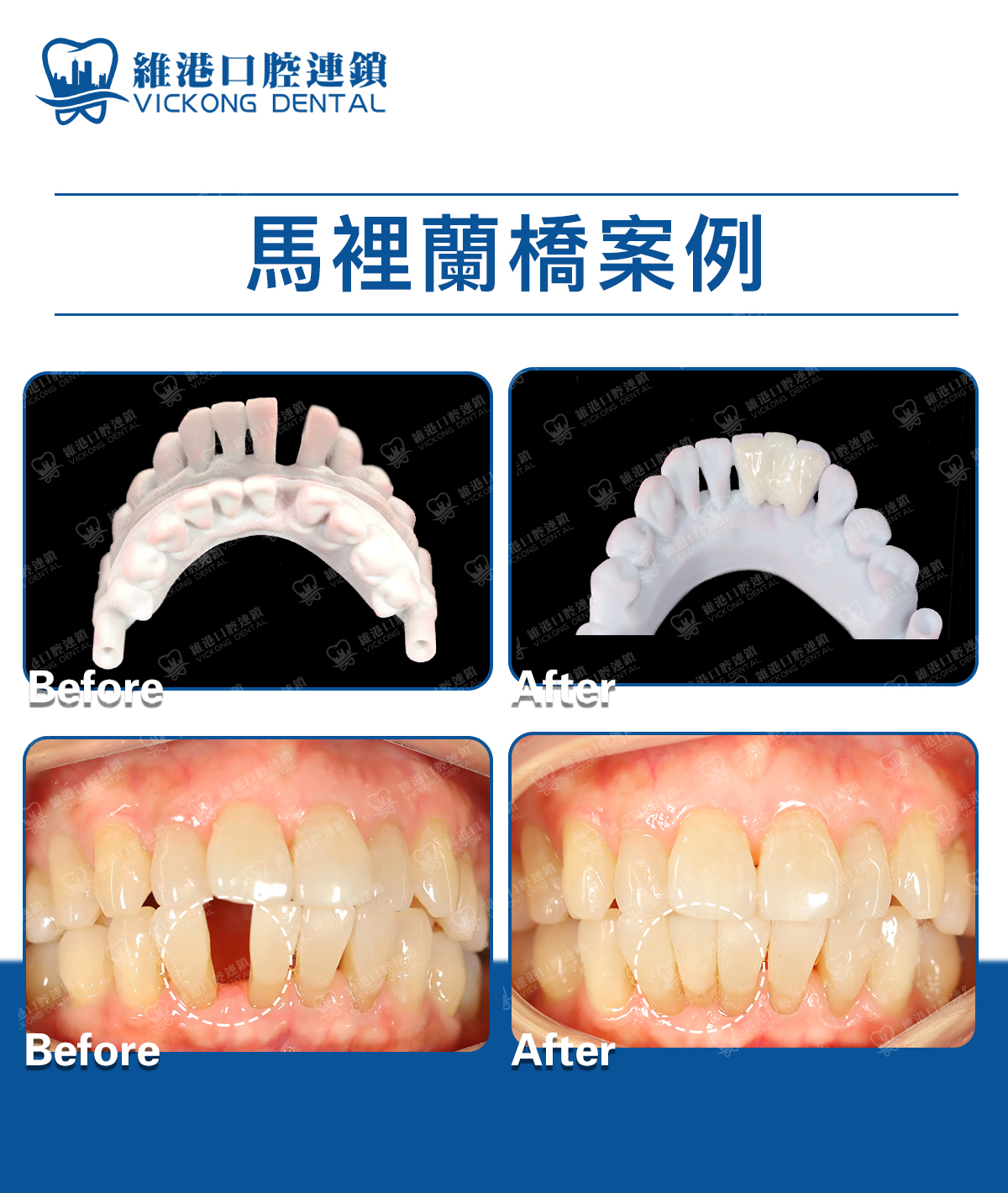 深圳睇牙邊家好