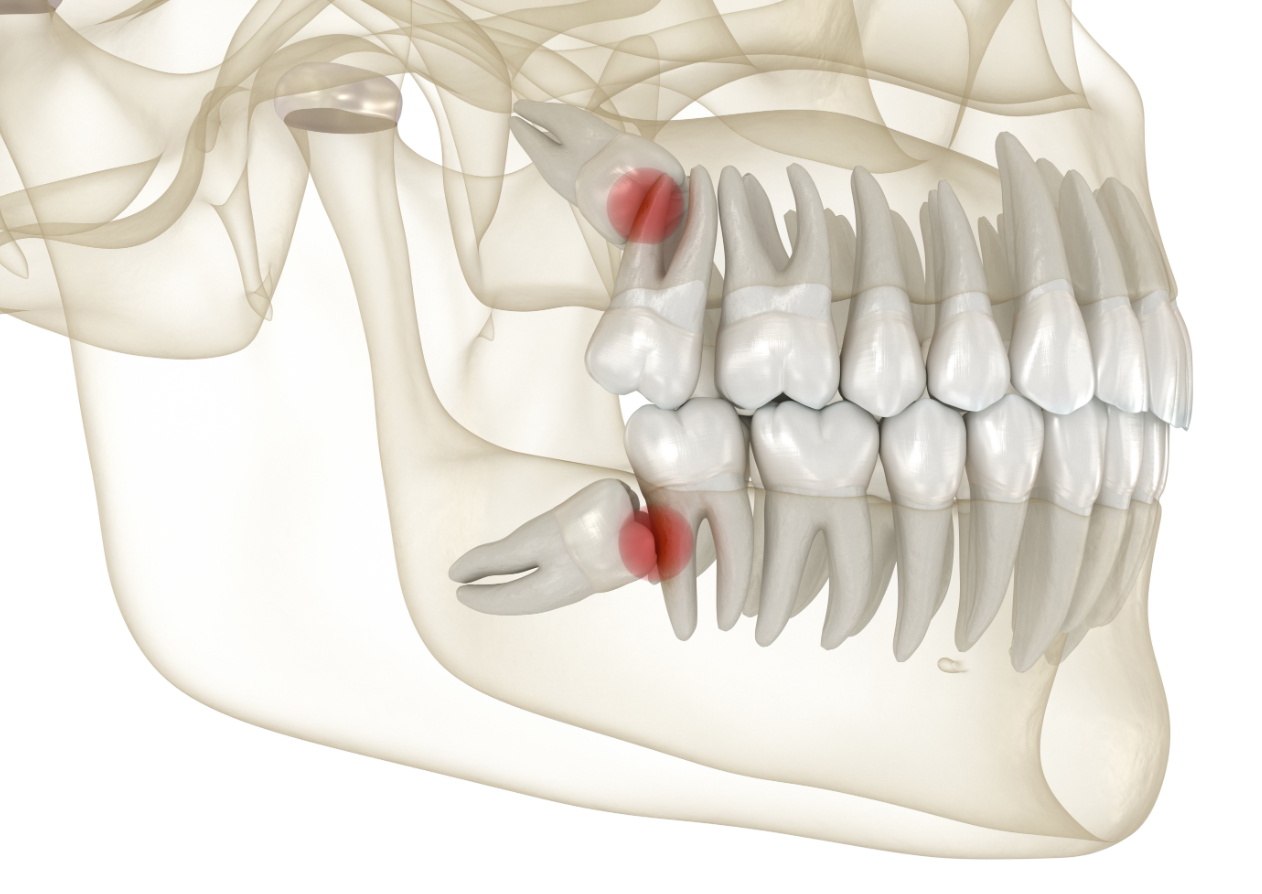深圳掹牙 深圳掹牙