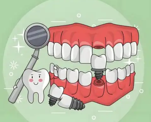 大陸種牙邊度好