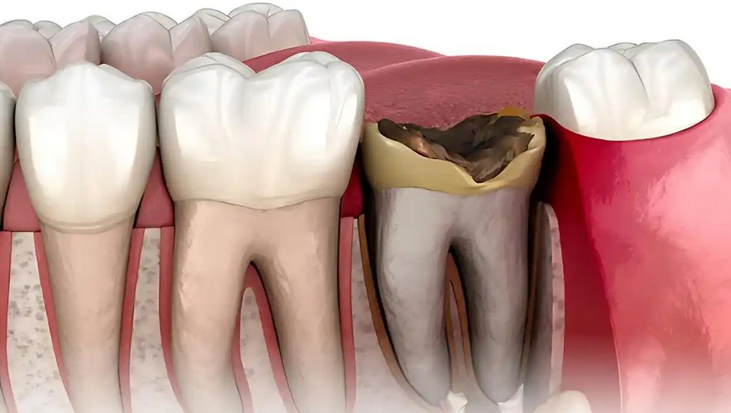 深圳杜牙根推薦