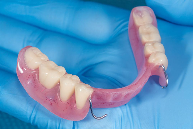 羅湖活動假牙 羅湖活動假牙