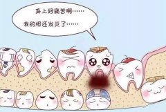 【深圳兒童牙科】小朋友不吃糖還會有蛀牙嗎？