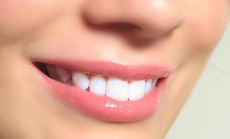 健康的牙齿-维港口腔连锁-维港欢笑口腔