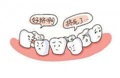 【深圳牙齒矯正】牙齒什麼情況進行牙齒矯正需要拔牙呢？