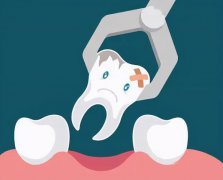 【深圳拔牙】怎樣預防拔牙後出現幹槽症呢？
