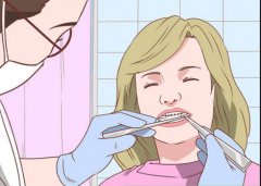 深圳箍牙科普-牙齒矯正的方法有哪些？