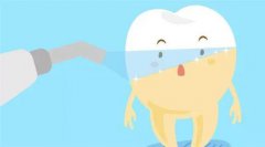 深圳洗牙科普-洗牙會使牙齒變白嗎？