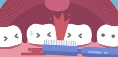牙周炎與全身哪些疾病有關？