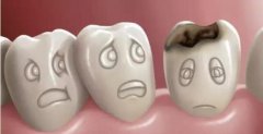 齲壞牙牙痛有什麼特點