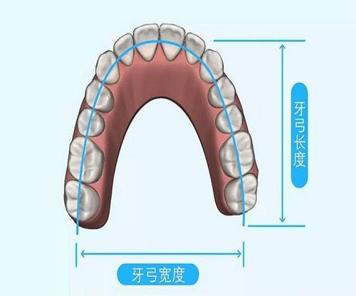 深圳箍牙價目表