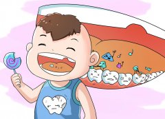 牙菌斑與齲齒有何關係？