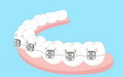 牙齒矯正對臉型有影響嗎？