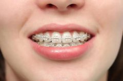 牙周病的治療為什麼要修復及正畸？