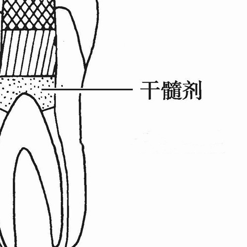 深圳杜牙根