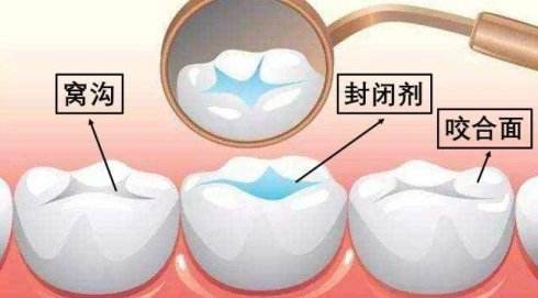 深圳窩溝封閉