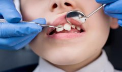 兒童牙病治療時拍X線片的意義是什麼？