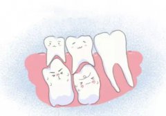 換牙期的紊亂會造成牙齒畸形嗎？