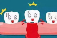牙周疾病會傳染、遺傳嗎？