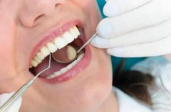 什麼是牙周病的三級預防？