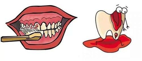 牙齦出血