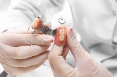 活動假牙修復前為什麼要磨損牙齒呢？