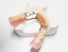 活動假牙的卡環會傷害牙齒嗎？