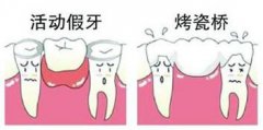為什麼有時鑲牙前還需要做手術？